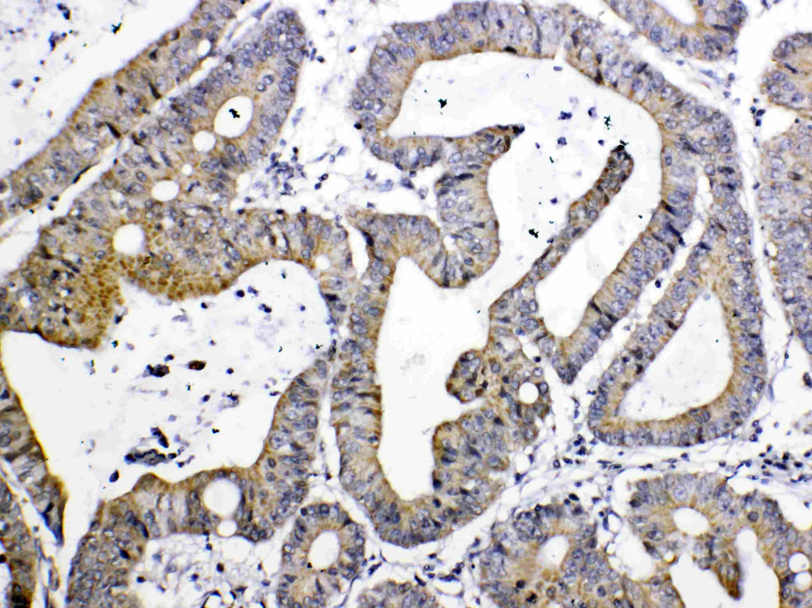 Polyclonal Rabbit anti-Human TIMP4 Antibody (IHC, WB)