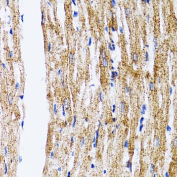Polyclonal Rabbit anti-Human MAP1LC3B / LC3B Antibody (IHC, WB)