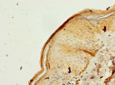 Polyclonal Rabbit anti-Human MRPL53 Antibody (IHC)