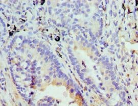 Polyclonal Rabbit anti-Human STOM / Stomatin Antibody (aa55-288, IHC, WB)