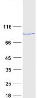 Human SMYD4 Protein (Recombinant Myc-DDK (Flag))