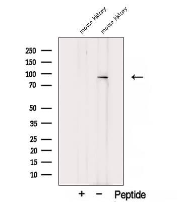 Polyclonal Rabbit anti-Human TGM1 / Transglutaminase Antibody (WB)