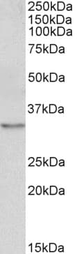 IHC-plus™ TPM4 Antibody (aa266-276)