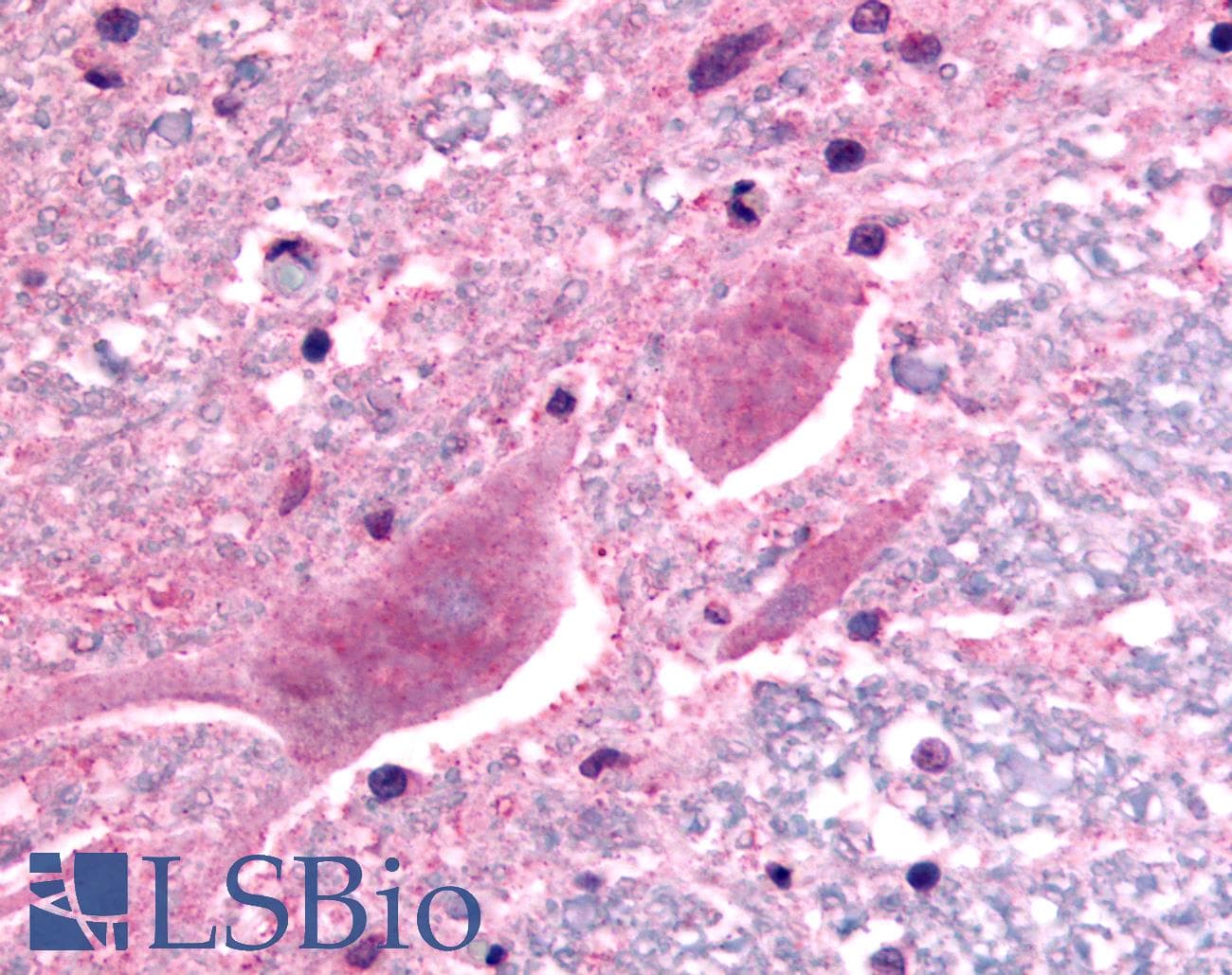 IHC-plus™ Polyclonal Rabbit anti-Human SCN3A / Nav1.3 Antibody (C-Terminus, IHC)