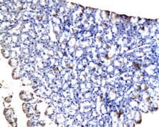 Gastric Inhibitory Peptide Antibody