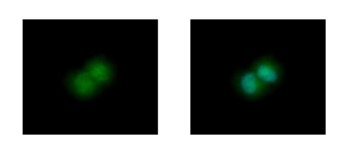 IHC-plus™ GLO1 / Glyoxalase I Antibody (aa1-184)
