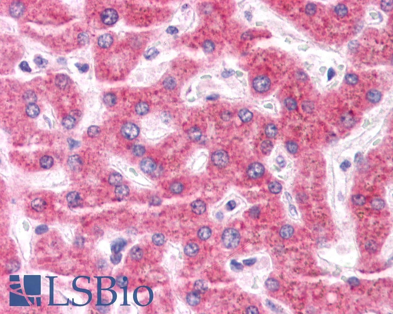 IHC-plus™ ENPP3 / CD203c Antibody (Internal)