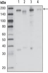 Monoclonal Mouse anti-Human MST1R / RON Antibody (clone 1B5A9, WB)