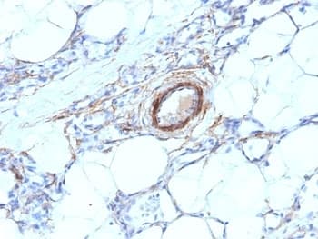 SMMHC / MYH11 Antibody (clone MYH11/923)
