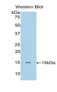 SIGIRR Antibody (aa1-118)