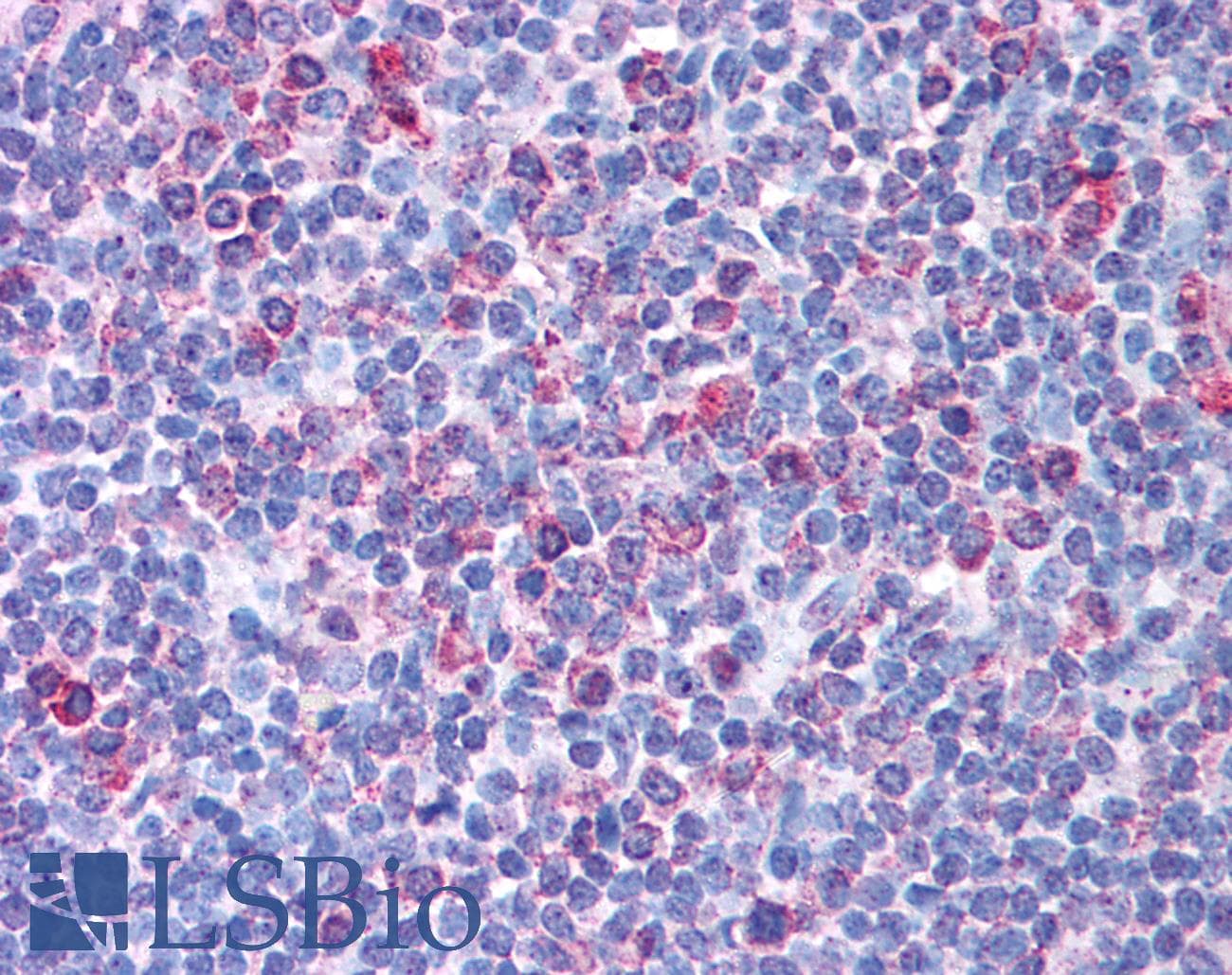 TRIM13 Antibody (aa165-214)