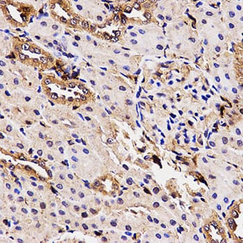 BCHE / Cholinesterase Antibody