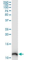 S100A10 Antibody (clone 3E10)