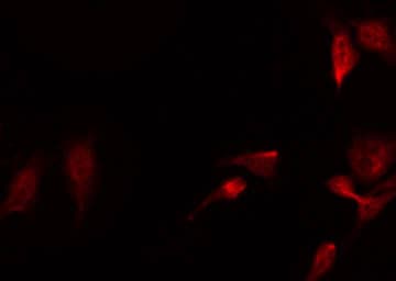 EIF4EBP1 / 4EBP1 Antibody (phospho-Thr36)