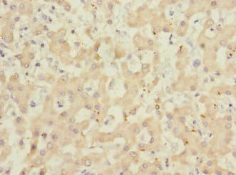 ADAMTSL4 Antibody