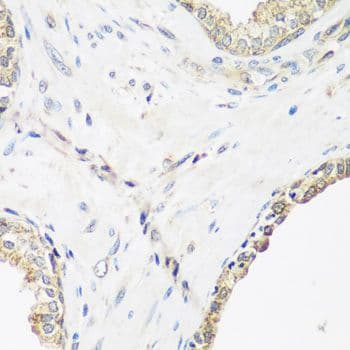 Polyclonal Rabbit anti-Human PYCR1 Antibody (IHC, WB)