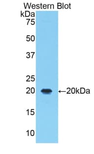 ALOX5 / 5-LOX Antibody (aa374-536)