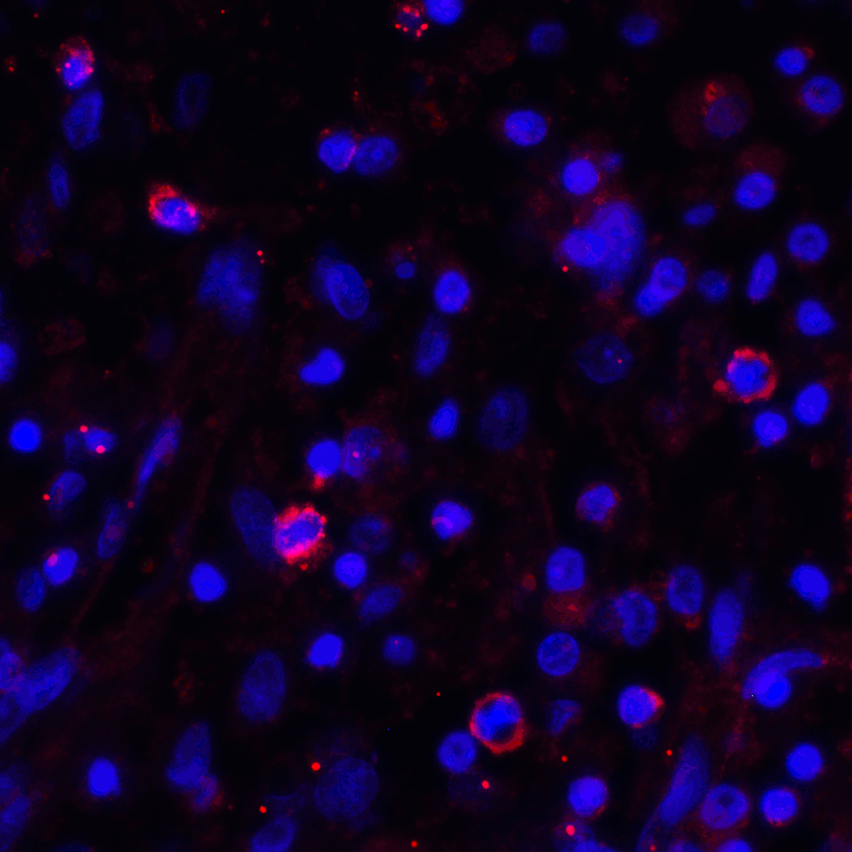 Monoclonal Mouse anti-Human CD274 / B7-H1 / PD-L1 Antibody (clone 2D6, IHC, IF, WB)