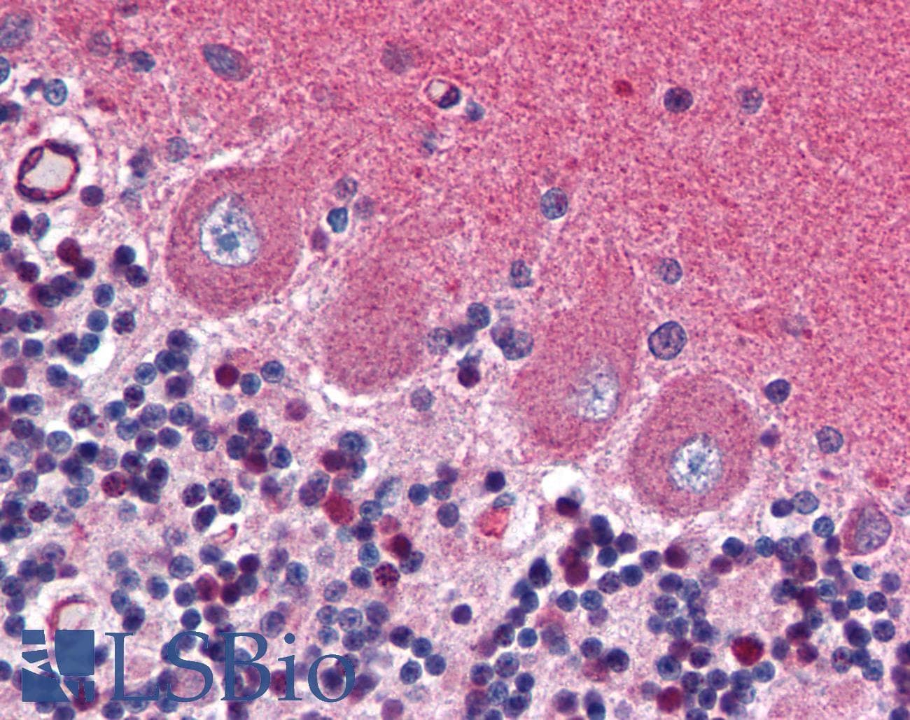 IHC-plus™ Monoclonal Mouse anti-Human GRIA2 / GLUR2 Antibody (aa175-430, IHC, WB)