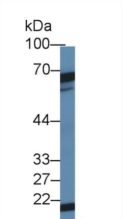 DKC1 / Dyskerin Antibody (aa298-509)