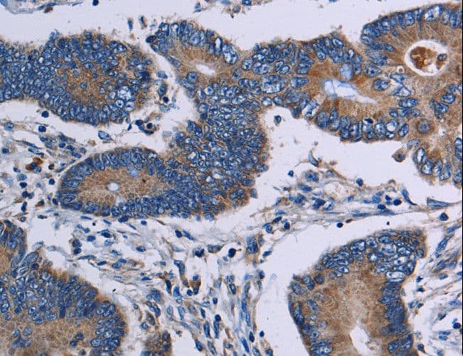 ITK / EMT Antibody