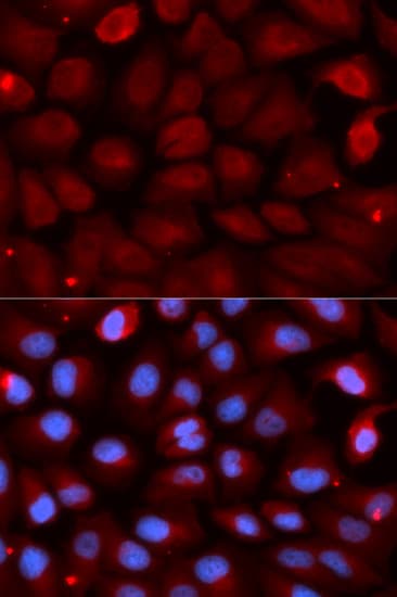 Polyclonal Rabbit anti-Human FMR1 / FMRP Antibody (IHC, IF, WB)