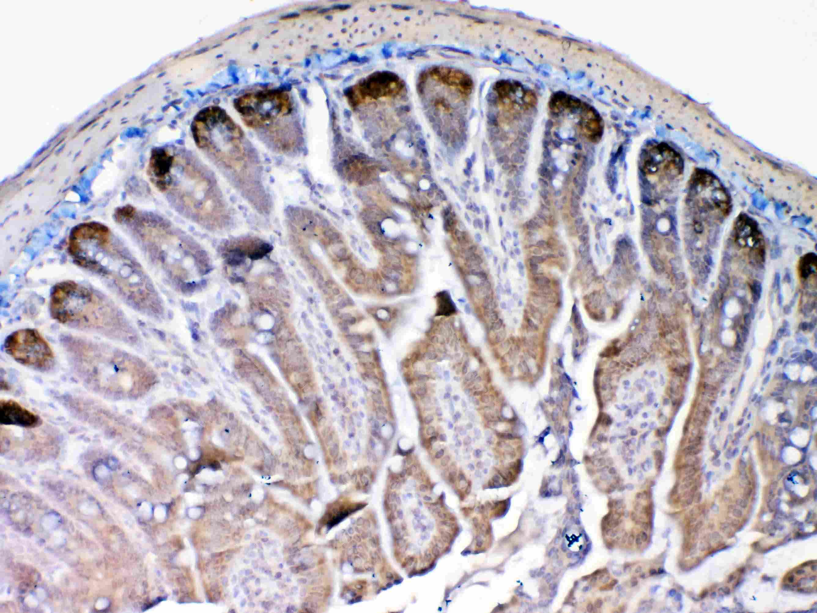 MMP13 Antibody
