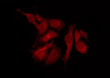 Polyclonal Rabbit anti-Human ZC3H11A Antibody (IF, WB)