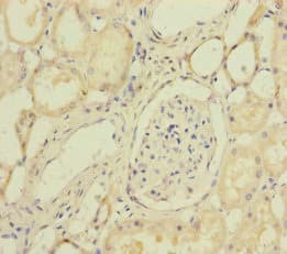 SUCLA2 Antibody