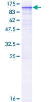 Human TNNI3K / CARK Protein (Recombinant GST)