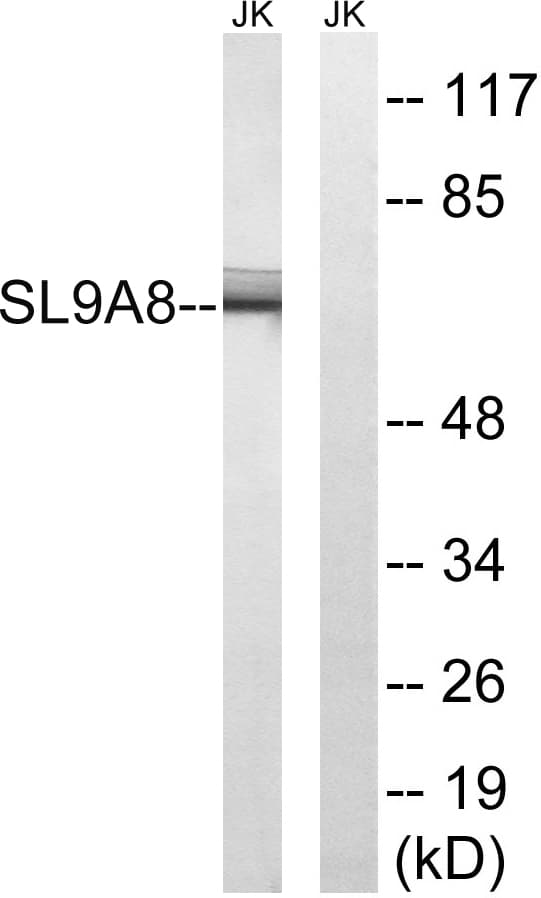 SLC9A8 / NHE8 Antibody (aa451-500)