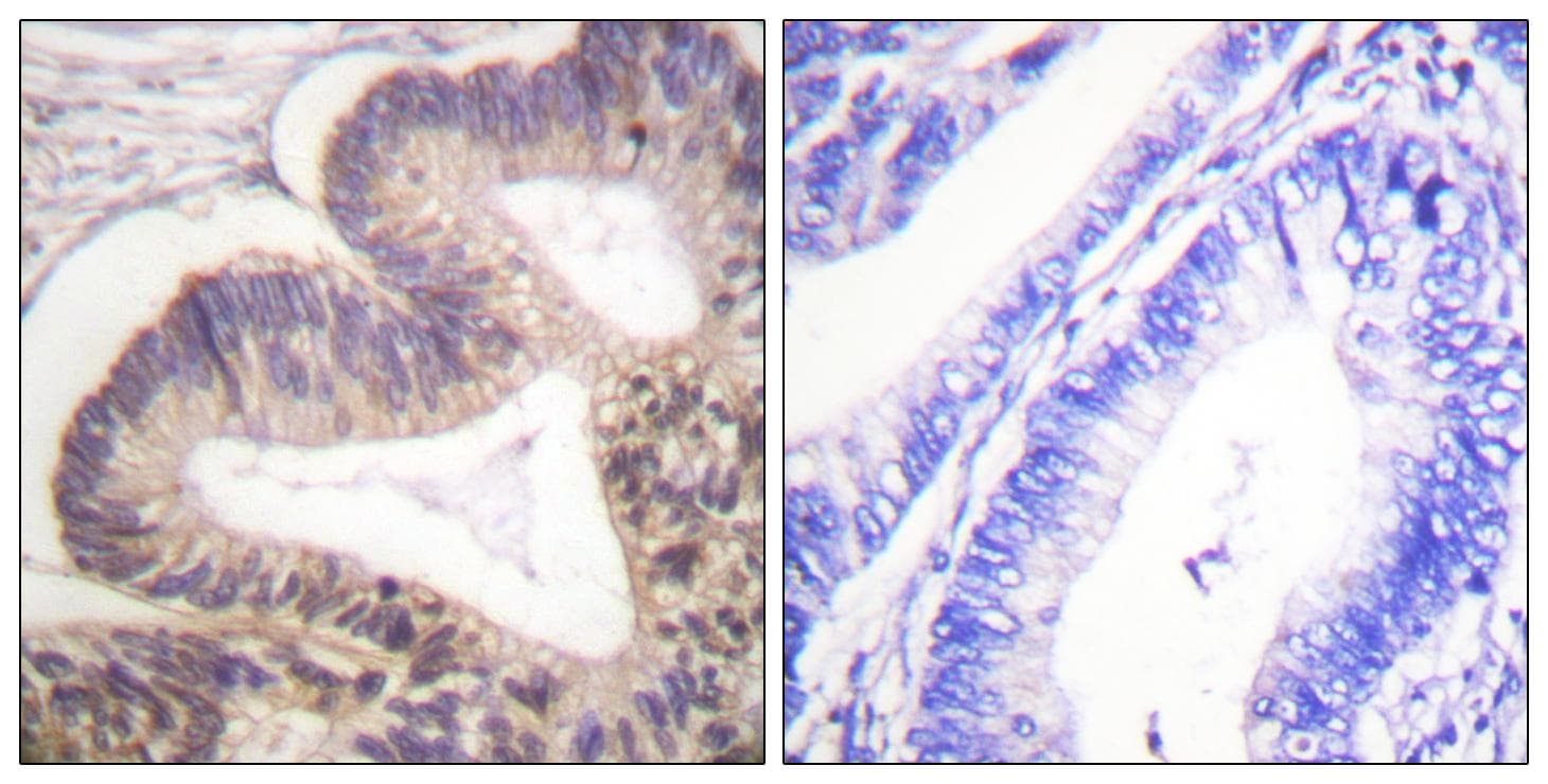 PAK2 Antibody (phospho-Ser20)