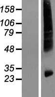 HIATL1 Protein (Over-Expression Lysate Myc-DDK (Flag))