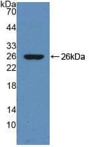 DNM1 / Dynamin Antibody (aa572-745)