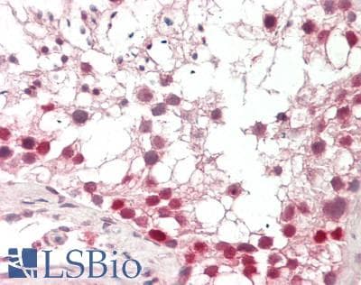 IHC-plus™ DMRT1 Antibody (aa1-210, clone 2H1)