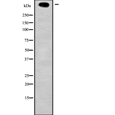 KMT2D / MLL2 Antibody