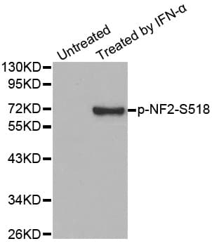 Polyclonal Rabbit anti-Human NF2 / Merlin Antibody (phospho-Ser518, IF, WB)