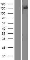 TRPM5 Protein (Over-Expression Lysate Myc-DDK (Flag))