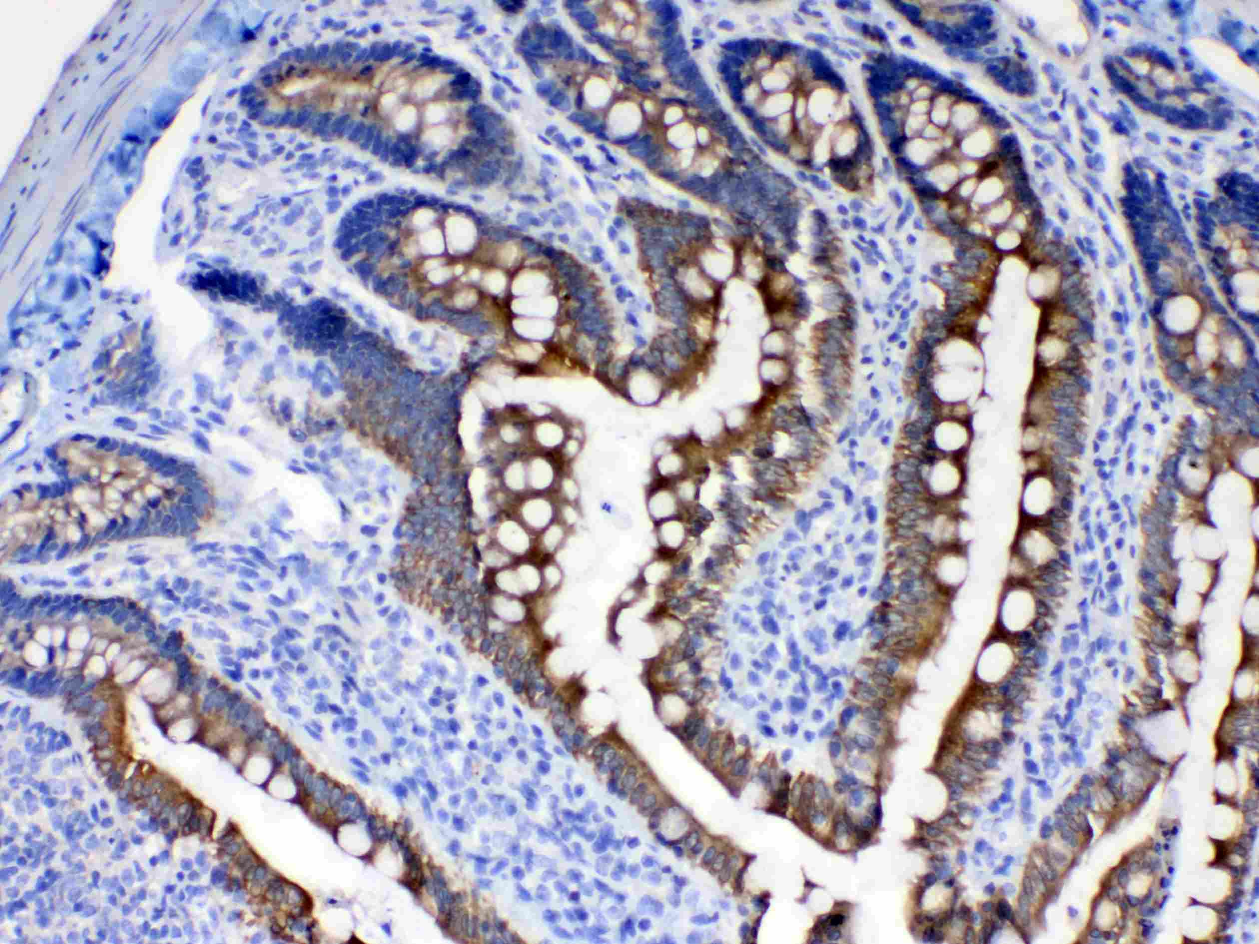 KRT8 / CK8 / Cytokeratin 8 Antibody