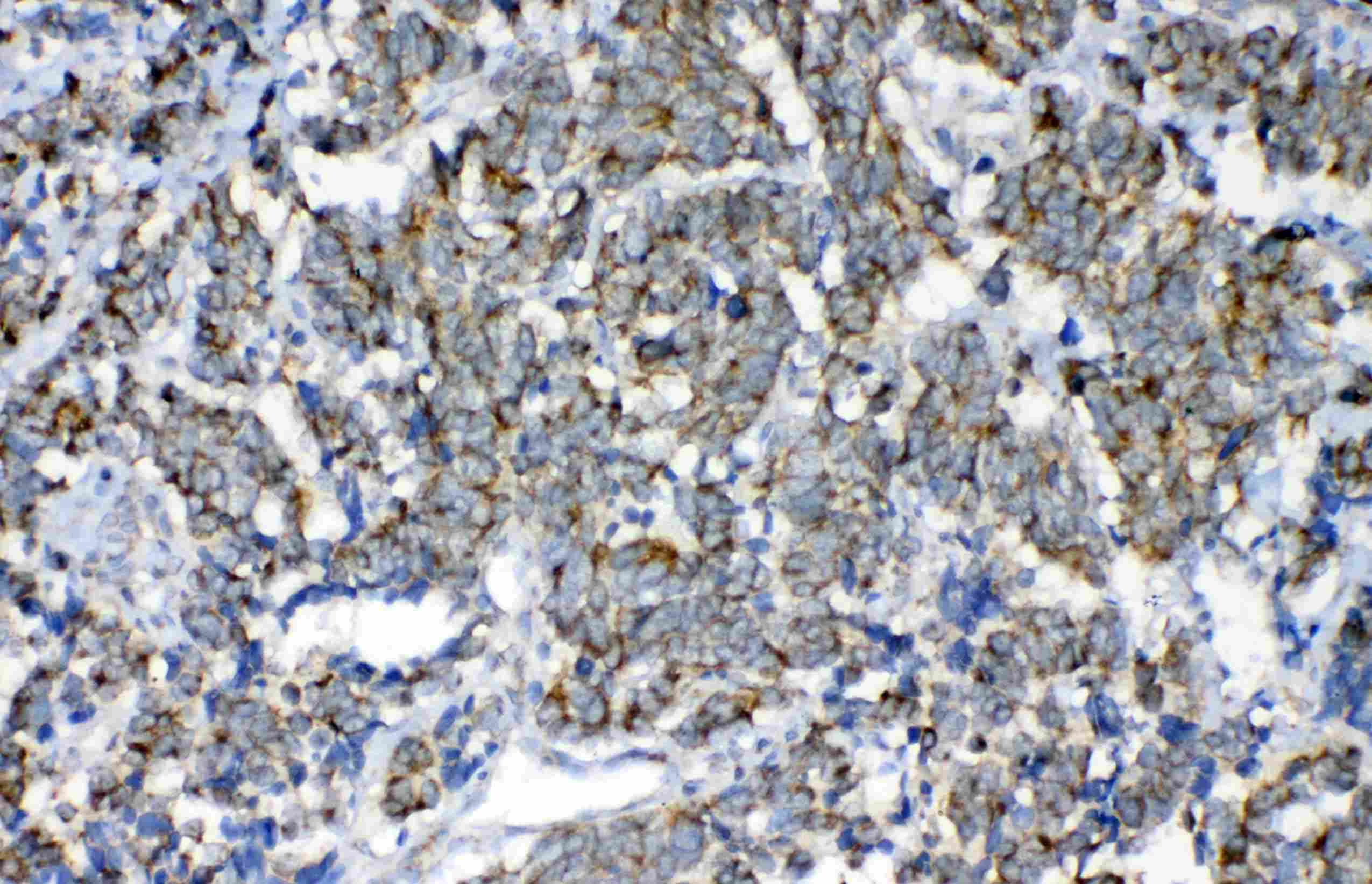 Polyclonal Rabbit anti-Human FH / Fumarase / MCL Antibody (IHC, WB)