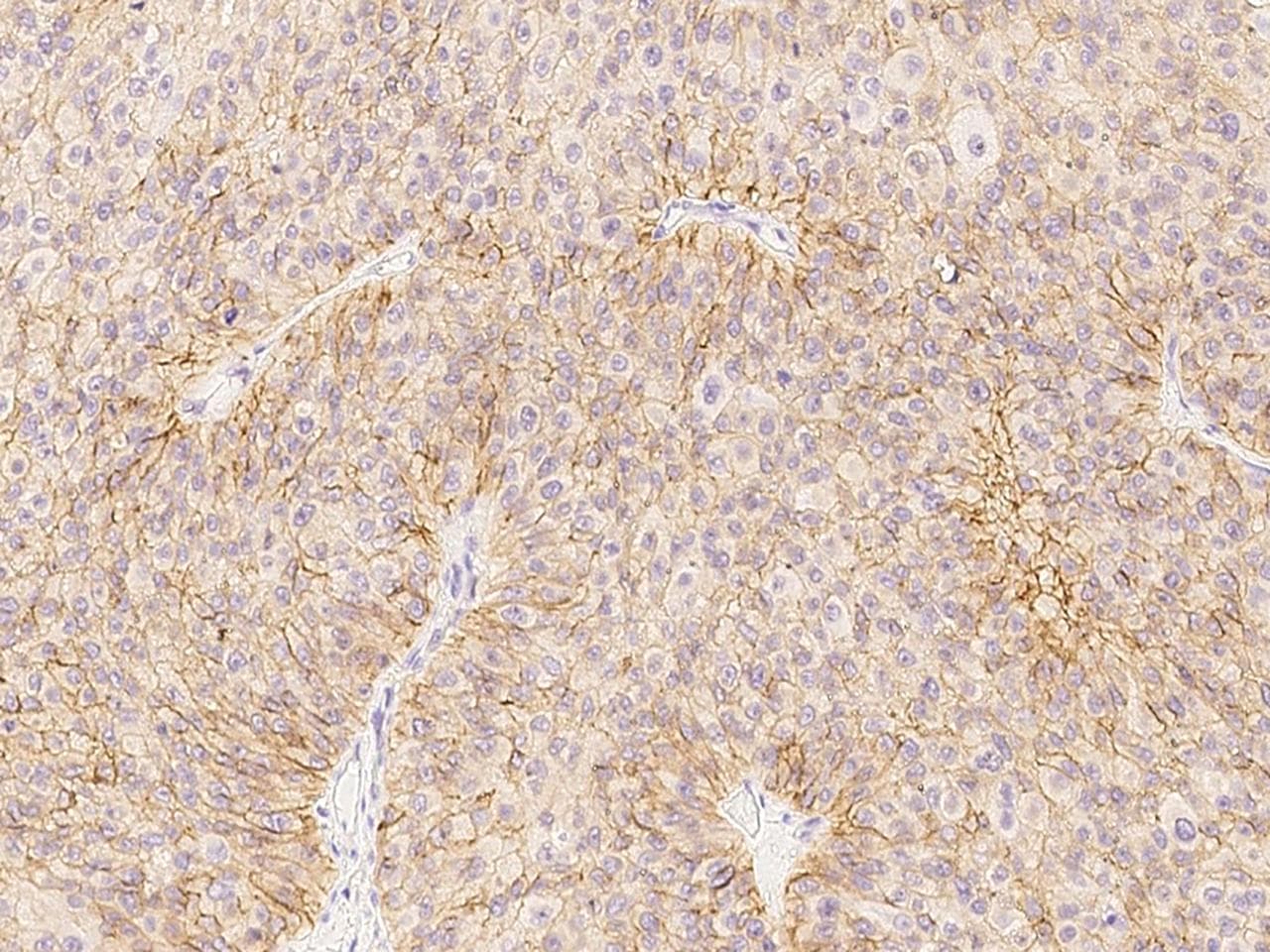 CXADR Antibody (Preservative Free)