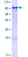 Human ANKS3 Protein (Recombinant GST)