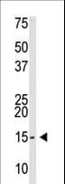 Polyclonal Rabbit anti-Human SUMO2 + SUMO3 Antibody (aa38-64, WB)
