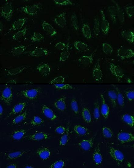Polyclonal Rabbit anti-Human NDUFA4 Antibody (IF)