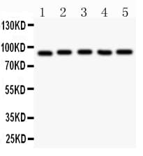 Polyclonal Rabbit anti-Human ARNT / HIF-1-Beta Antibody (aa416-789, WB)