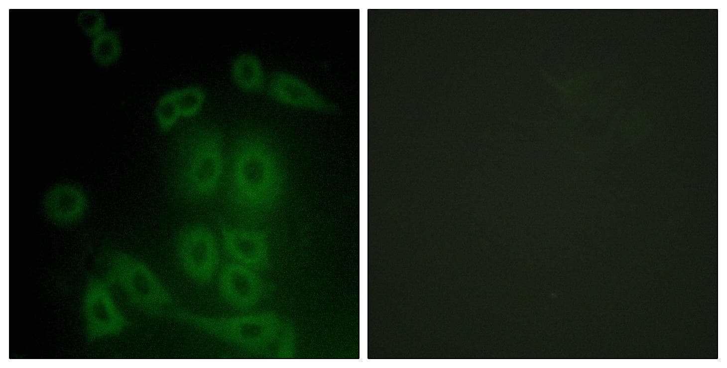 Polyclonal Rabbit anti-Human FXR2 Antibody (IHC, IF, WB)