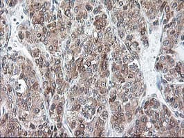 RPN1 / Ribophorin I Antibody (clone OTI6A9)