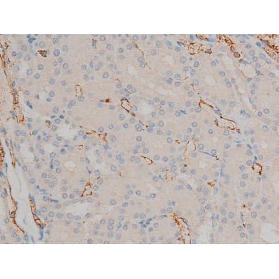 Polyclonal Rabbit anti-Human BCL2 / Bcl-2 Antibody (phospho-Ser70, IHC, IF, WB)