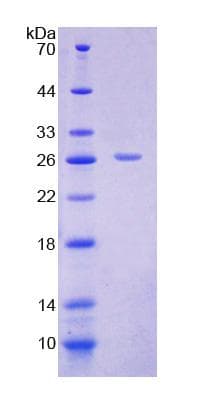 Rat SLC25A20 / CACT Protein (Recombinant His-T7)