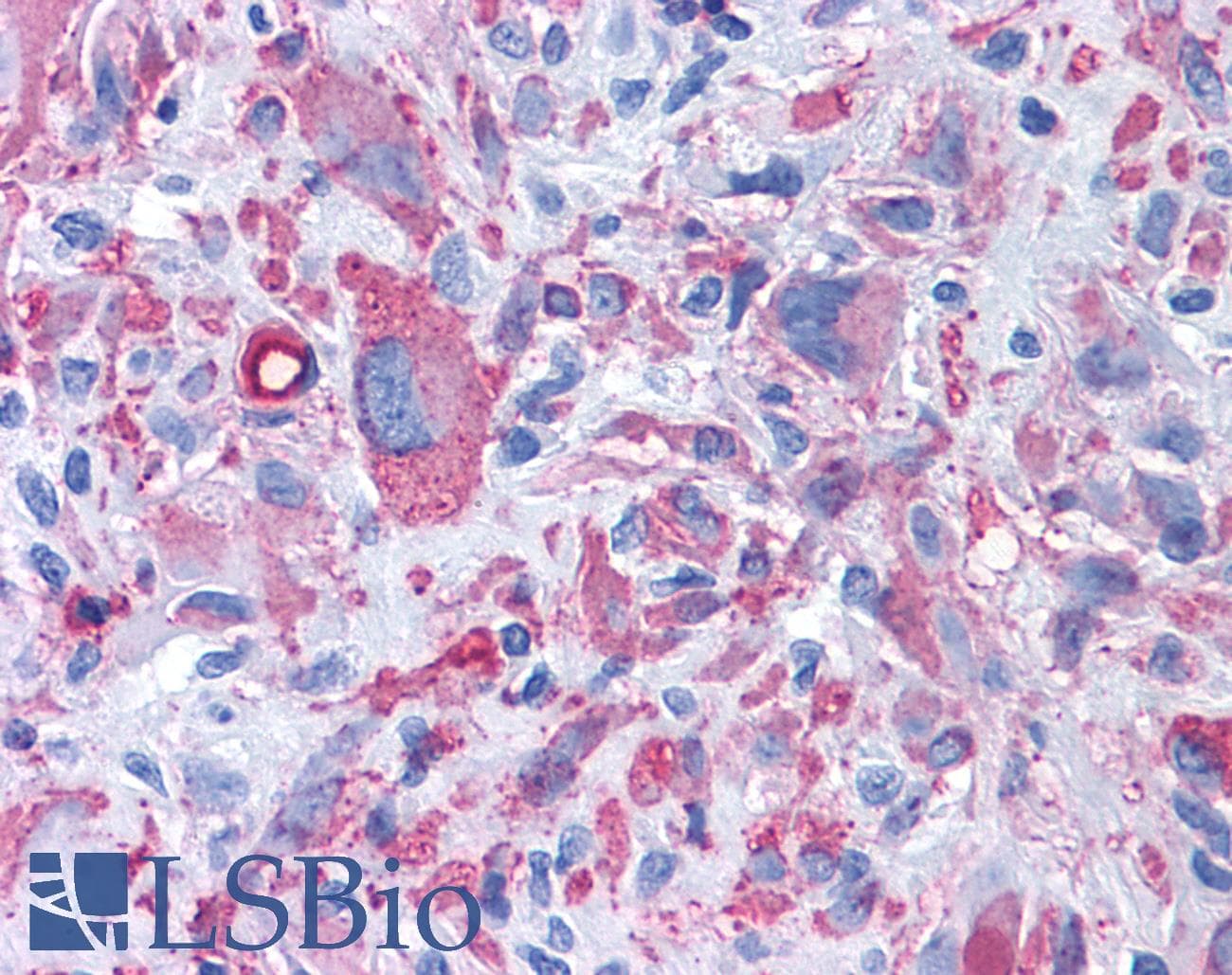 PathPlus™ Polyclonal Rabbit anti-Human CRFR1 / CRHR1 Antibody (Extracellular Domain, IHC)